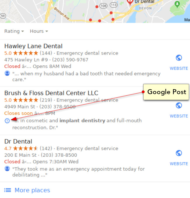 Des Google Posts dans le 3-pack local mettant en vedette Hawley Lane Dental, Brush & Floss Dental Center LLC, et Dr Dental